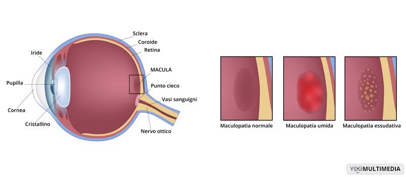 test genetico per maculopatia