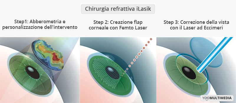 Astigmatismo descrizione, sintomi e cura