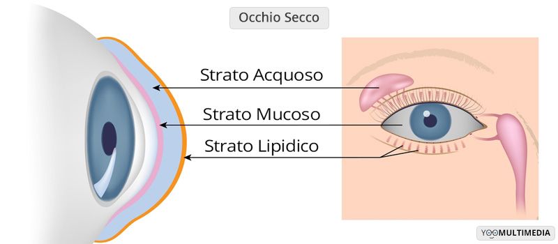 Occhio secco descrizione, sintomi e cure
